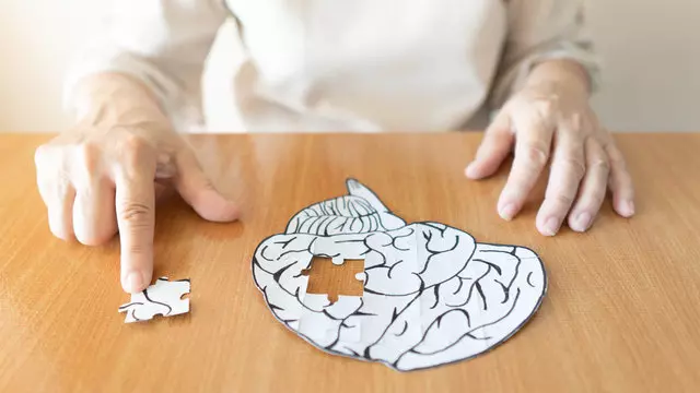 Alzheimer en la vejez - Cuida tu salud hoy